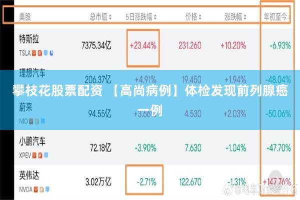 攀枝花股票配资 【高尚病例】体检发现前列腺癌一例